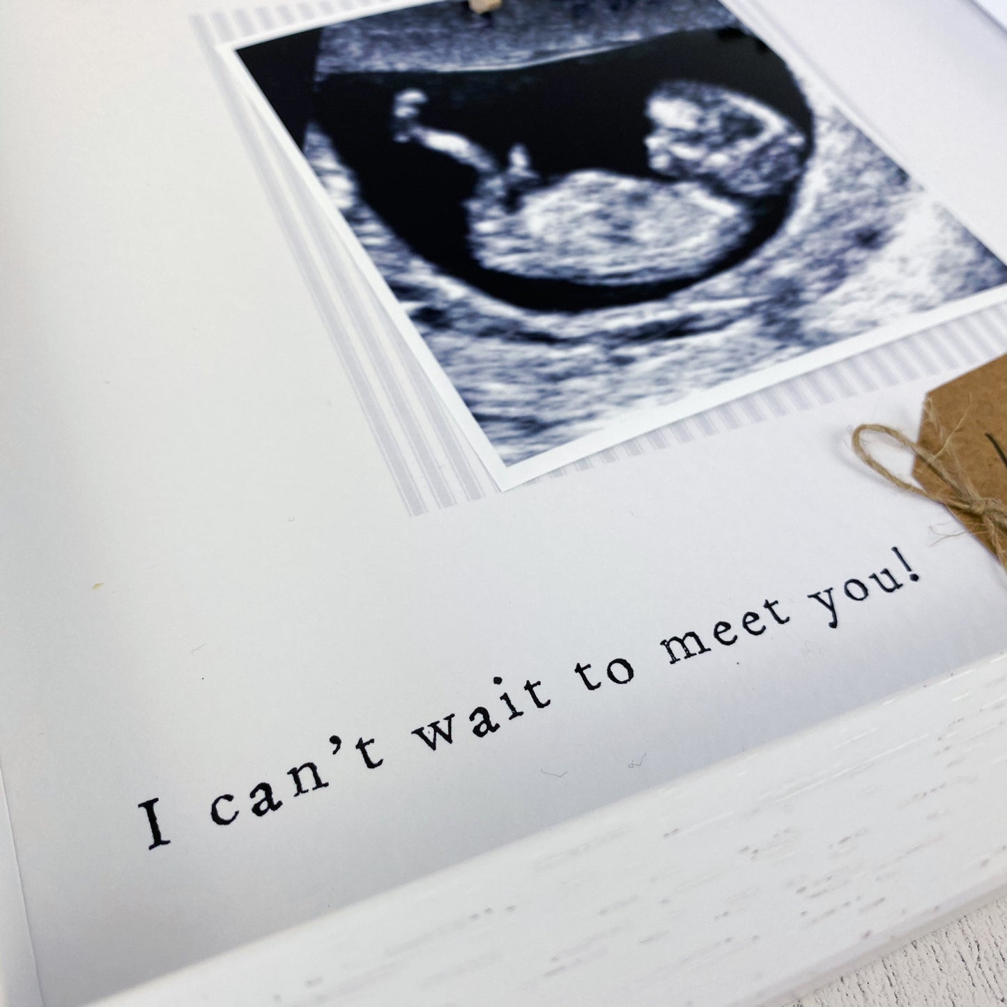 Baby Scan Photo Frame